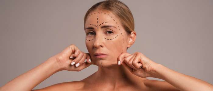 facelift surgery in Hyderabad at kinnera aesthetica
