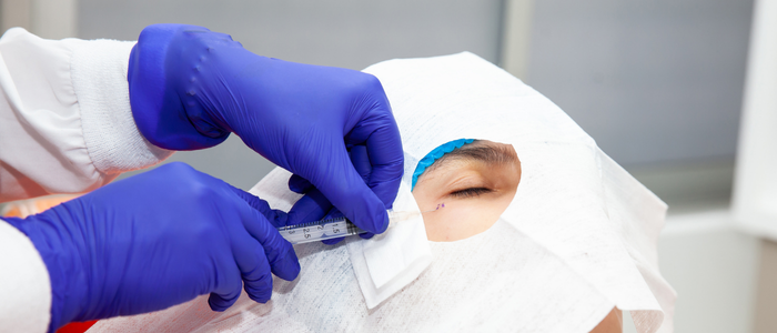Local anesthesia procedures for skin or face